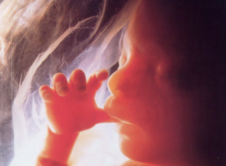 Si 73 millones de abortos al año son un “derecho”